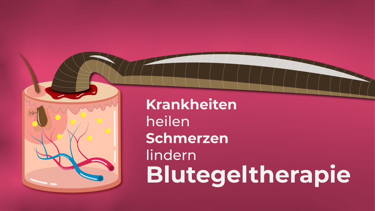 Blutegeltherapie, Krankheiten und Schmerzen lindern